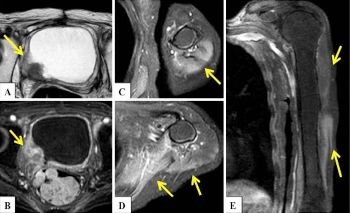 https://cdn.ncbi.nlm.nih.gov/pmc/blobs/2192/5548690/1c8ee4264b13/1349-7235-56-1915-g001.jpg