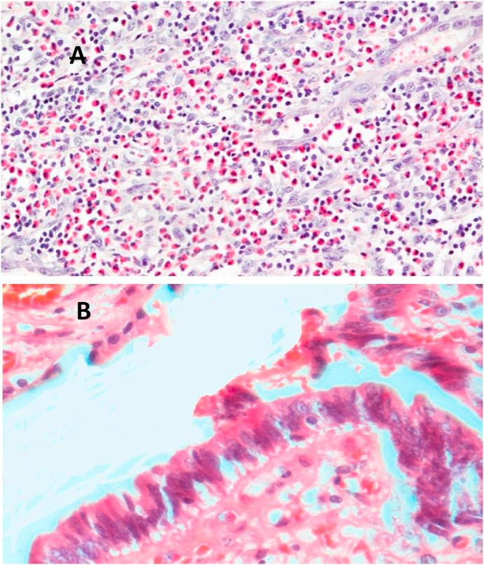 https://cdn.ncbi.nlm.nih.gov/pmc/blobs/21a3/7677112/5bbe15ab84ca/gr3.jpg