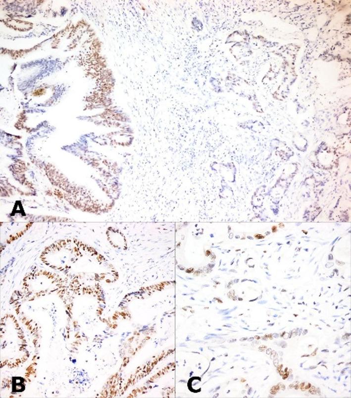 https://cdn.ncbi.nlm.nih.gov/pmc/blobs/21ad/12179014/ee50e2d57cfe/12672_2025_2990_Fig4_HTML.jpg