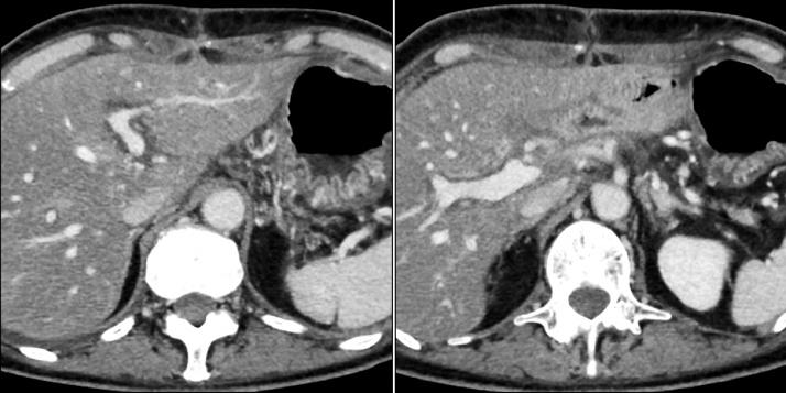 https://cdn.ncbi.nlm.nih.gov/pmc/blobs/21af/5723364/a8c2808dc4e3/gr3.jpg
