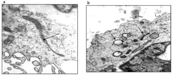 https://cdn.ncbi.nlm.nih.gov/pmc/blobs/21b2/9415174/26f301f7d33d/pathogens-11-00889-g010.jpg