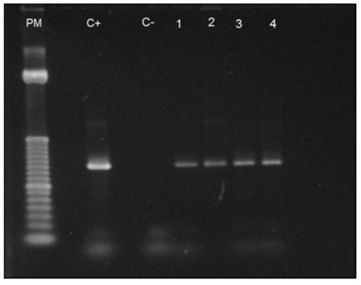 https://cdn.ncbi.nlm.nih.gov/pmc/blobs/21b2/9415174/45db048601ce/pathogens-11-00889-g003.jpg