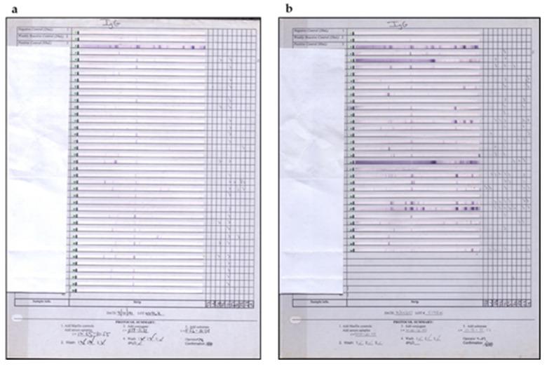 https://cdn.ncbi.nlm.nih.gov/pmc/blobs/21b2/9415174/8c869a34cf4a/pathogens-11-00889-g011.jpg