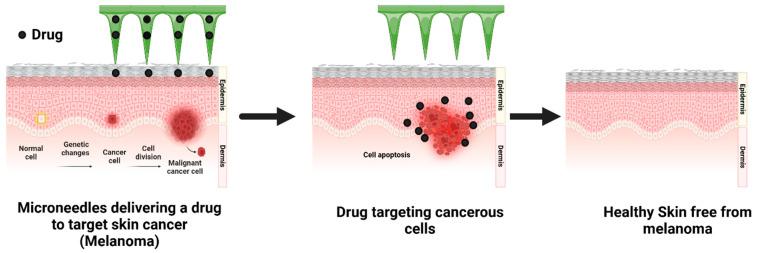 https://cdn.ncbi.nlm.nih.gov/pmc/blobs/21b4/12114660/27912464b863/pharmaceutics-17-00579-g001.jpg