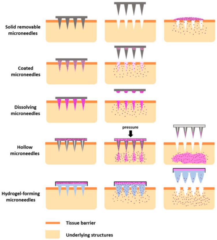 https://cdn.ncbi.nlm.nih.gov/pmc/blobs/21b4/12114660/6fbbb95bdf13/pharmaceutics-17-00579-g002.jpg