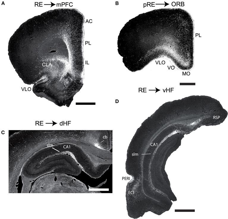 https://cdn.ncbi.nlm.nih.gov/pmc/blobs/21b7/9445584/9880953c7d81/fnbeh-16-964644-g0003.jpg