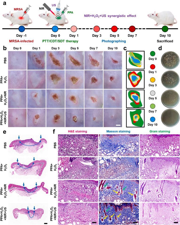 https://cdn.ncbi.nlm.nih.gov/pmc/blobs/21b9/12269415/e220801f428e/gr7.jpg