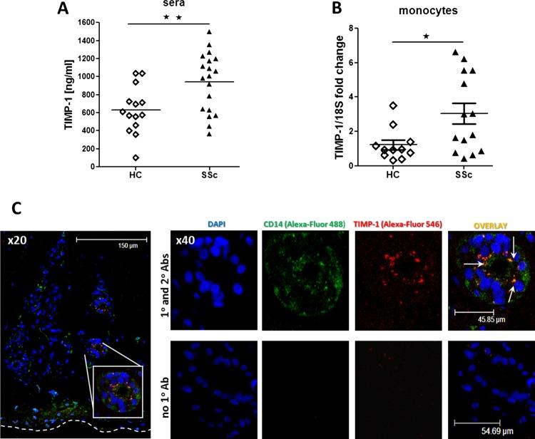 https://cdn.ncbi.nlm.nih.gov/pmc/blobs/21c6/3711494/c241ddd6a38d/annrheumdis-2012-201958f01.jpg