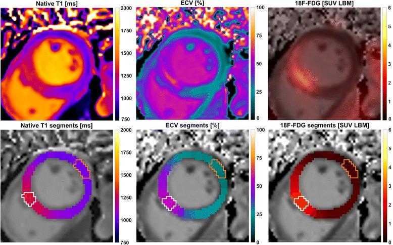https://cdn.ncbi.nlm.nih.gov/pmc/blobs/21c7/5967072/ca75b1868525/12968_2018_454_Fig1_HTML.jpg