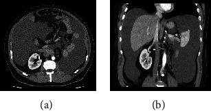https://cdn.ncbi.nlm.nih.gov/pmc/blobs/21c9/9705082/9d91a5491a35/CRIU2022-3817554.002.jpg