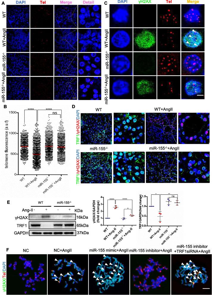 https://cdn.ncbi.nlm.nih.gov/pmc/blobs/21d0/11238407/6d621039f87c/12964_2024_1708_Fig5_HTML.jpg