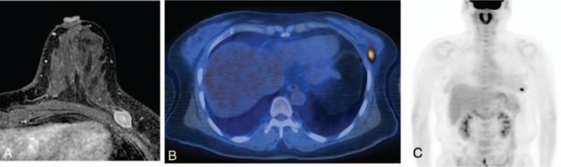 https://cdn.ncbi.nlm.nih.gov/pmc/blobs/21d0/5690765/1c6a6ce2f0b2/medi-96-e8557-g008.jpg
