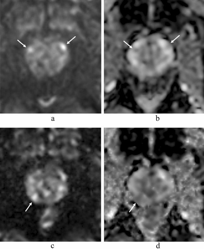 https://cdn.ncbi.nlm.nih.gov/pmc/blobs/21d1/9515065/b1cec5a77915/41598_2022_20518_Fig5_HTML.jpg