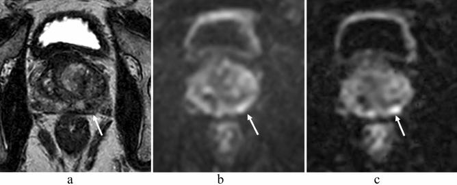 https://cdn.ncbi.nlm.nih.gov/pmc/blobs/21d1/9515065/c395cff673c3/41598_2022_20518_Fig4_HTML.jpg