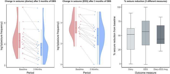 https://cdn.ncbi.nlm.nih.gov/pmc/blobs/21d2/9544037/0d38e5a91961/ANA-92-61-g001.jpg