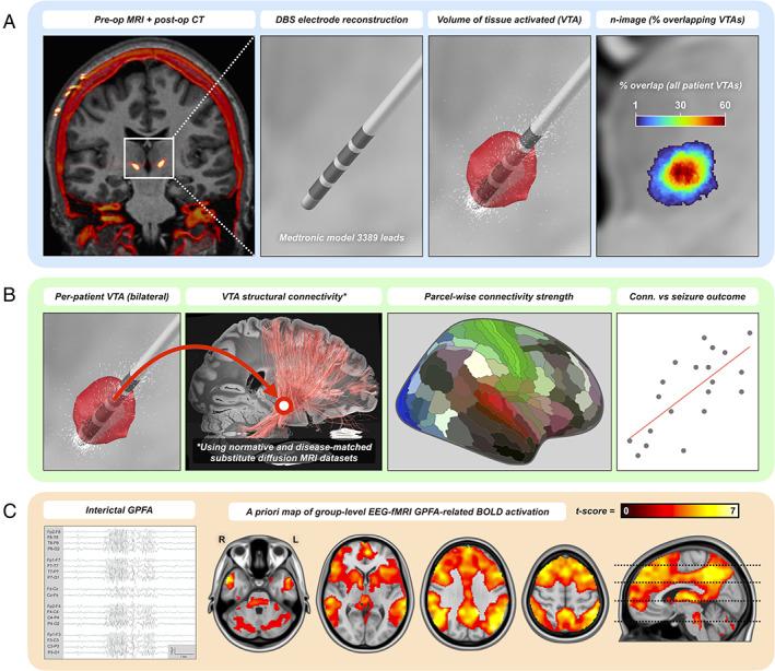 https://cdn.ncbi.nlm.nih.gov/pmc/blobs/21d2/9544037/ab31b82ca46e/ANA-92-61-g003.jpg
