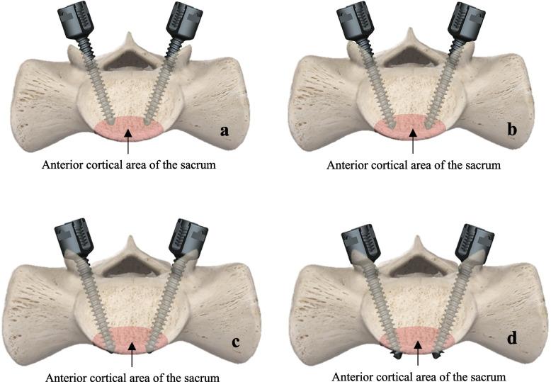 https://cdn.ncbi.nlm.nih.gov/pmc/blobs/21d3/11225279/a30e1883925a/12891_2024_7627_Fig1_HTML.jpg