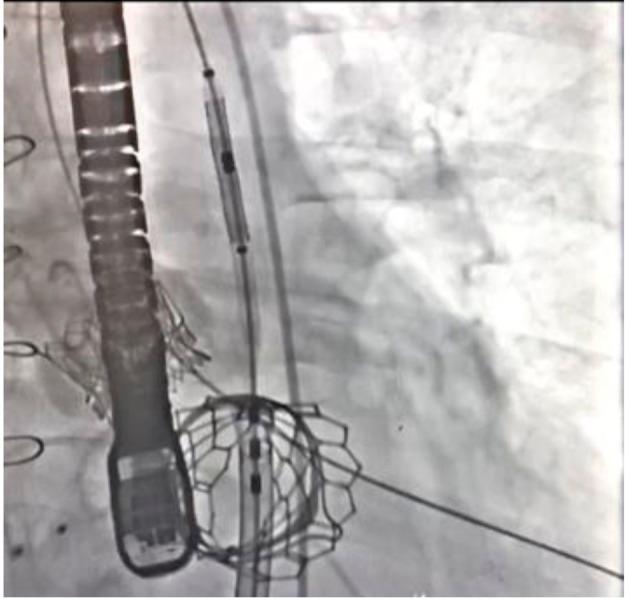 https://cdn.ncbi.nlm.nih.gov/pmc/blobs/21d6/6575110/0c6b74b1f52b/cr-10-193-g004.jpg