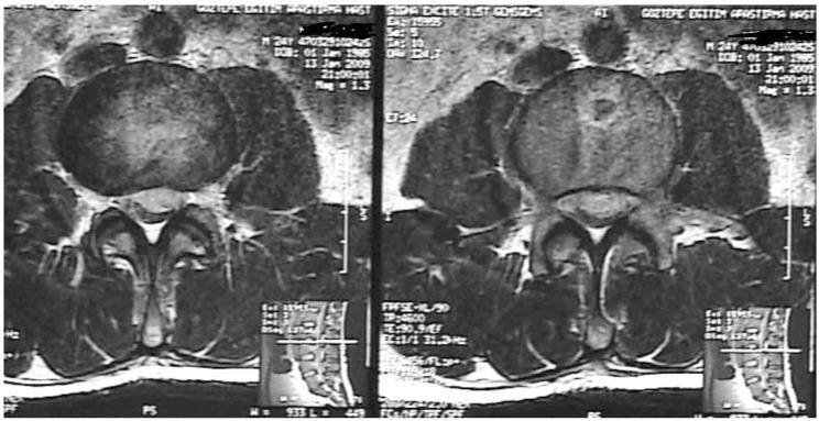 https://cdn.ncbi.nlm.nih.gov/pmc/blobs/21d7/4149998/f05bb2200688/asj-8-516-g003.jpg
