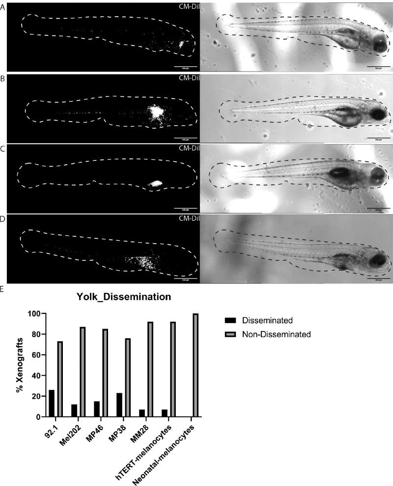 https://cdn.ncbi.nlm.nih.gov/pmc/blobs/21d9/11346061/b1774f296945/iovs-65-10-26-f001.jpg