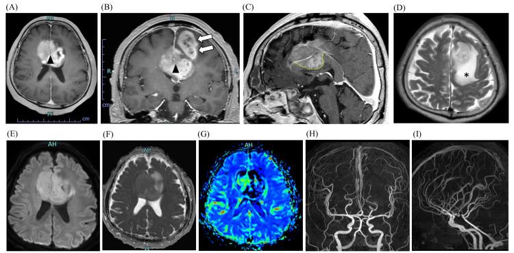 https://cdn.ncbi.nlm.nih.gov/pmc/blobs/21dc/12333896/580fb12b1ade/cureus-0017-00000087547-i01.jpg