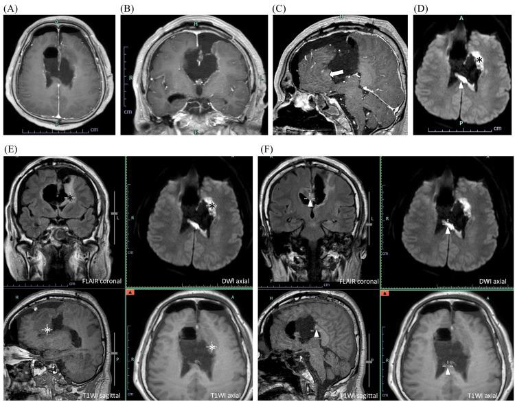 https://cdn.ncbi.nlm.nih.gov/pmc/blobs/21dc/12333896/b1bf38120814/cureus-0017-00000087547-i03.jpg