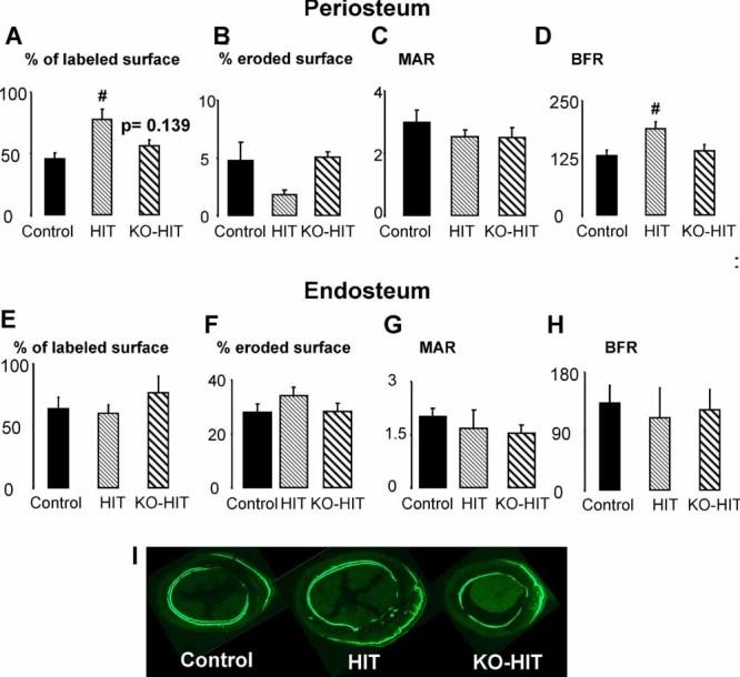 https://cdn.ncbi.nlm.nih.gov/pmc/blobs/21e0/3153133/5c636695c3e8/jbmr0025-1257-f5.jpg