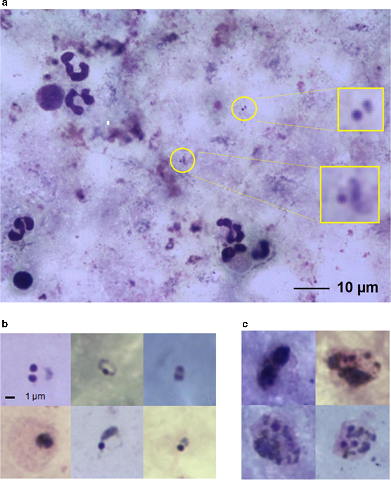 https://cdn.ncbi.nlm.nih.gov/pmc/blobs/21e4/6157053/7b05359684dd/12936_2018_2493_Fig1_HTML.jpg