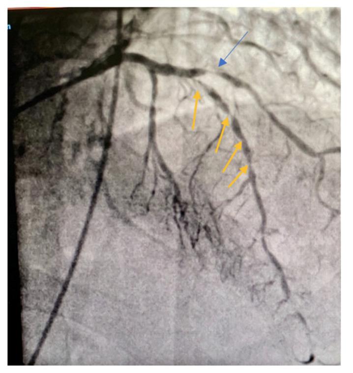 https://cdn.ncbi.nlm.nih.gov/pmc/blobs/21ec/8954667/01f2e211eb2c/jcdd-09-00083-g001.jpg