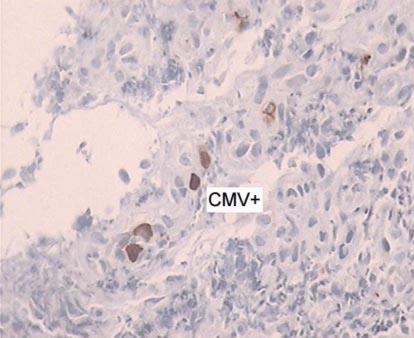 https://cdn.ncbi.nlm.nih.gov/pmc/blobs/21f2/2988918/a20306719e88/crg0003-0280-f01.jpg
