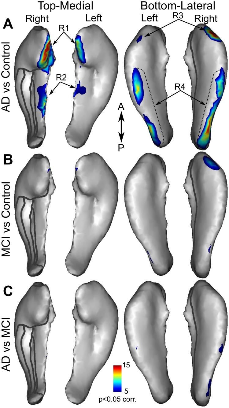 https://cdn.ncbi.nlm.nih.gov/pmc/blobs/21f5/3741167/5433b948d526/pone.0071354.g004.jpg