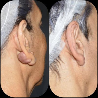 https://cdn.ncbi.nlm.nih.gov/pmc/blobs/21fb/10605762/4eaa95386881/SRT-29-e13506-g005.jpg