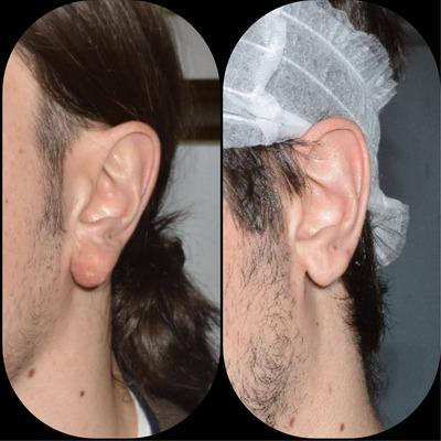 https://cdn.ncbi.nlm.nih.gov/pmc/blobs/21fb/10605762/5bb659db50ca/SRT-29-e13506-g007.jpg