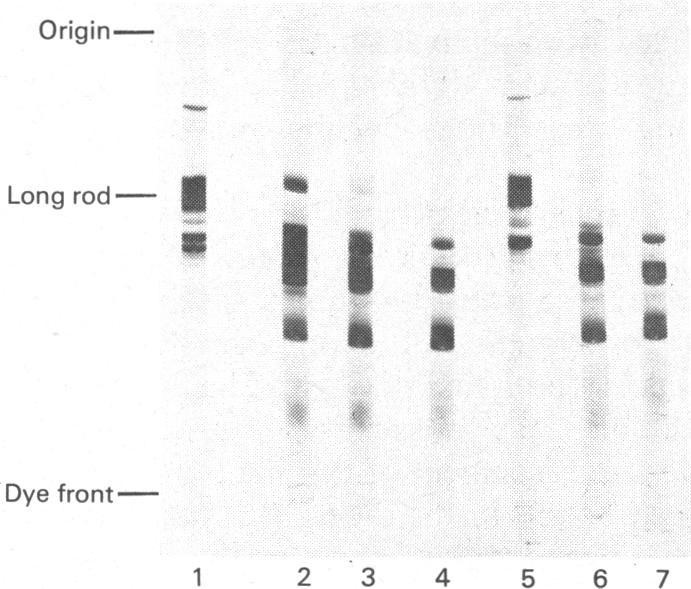 https://cdn.ncbi.nlm.nih.gov/pmc/blobs/21fb/1163640/630088983a79/biochemj00383-0036-b.jpg