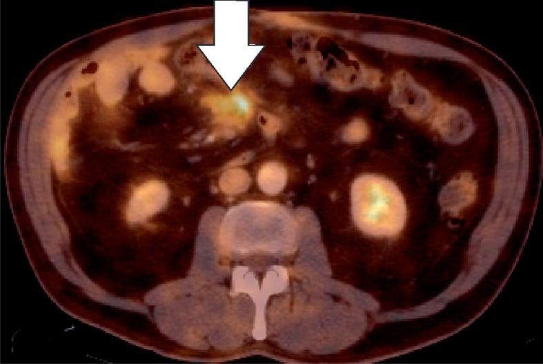 https://cdn.ncbi.nlm.nih.gov/pmc/blobs/21fd/7064015/3ccddd199b98/PJR-85-39908-g012.jpg