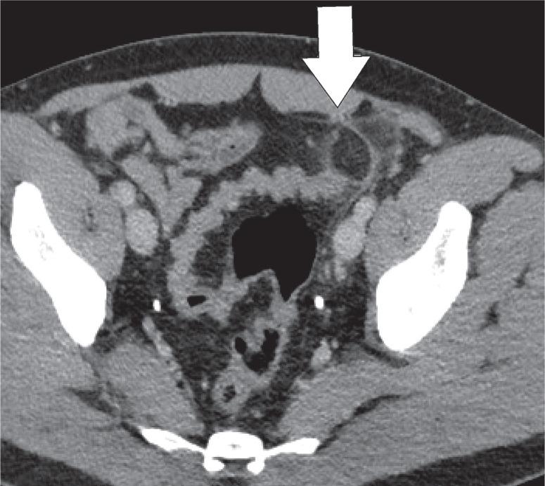 https://cdn.ncbi.nlm.nih.gov/pmc/blobs/21fd/7064015/cd2fe9756598/PJR-85-39908-g001.jpg