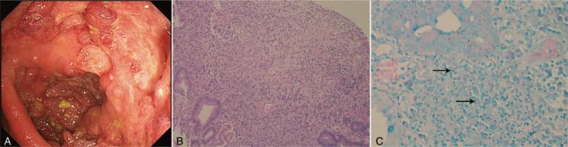 https://cdn.ncbi.nlm.nih.gov/pmc/blobs/21ff/6824802/135302218d78/medi-98-e17652-g004.jpg