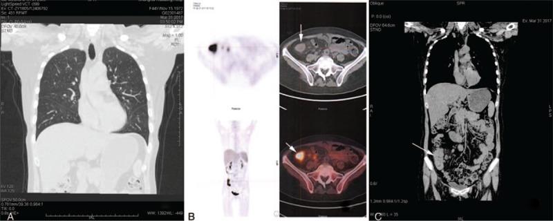 https://cdn.ncbi.nlm.nih.gov/pmc/blobs/21ff/6824802/42fd967470b7/medi-98-e17652-g003.jpg