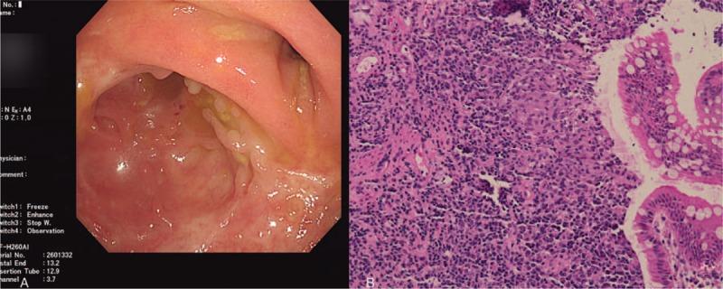 https://cdn.ncbi.nlm.nih.gov/pmc/blobs/21ff/6824802/530e2902af37/medi-98-e17652-g002.jpg