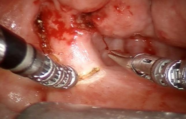 https://cdn.ncbi.nlm.nih.gov/pmc/blobs/2201/3544208/1b98ae9bd1f8/CTO-11-05-g-007.jpg