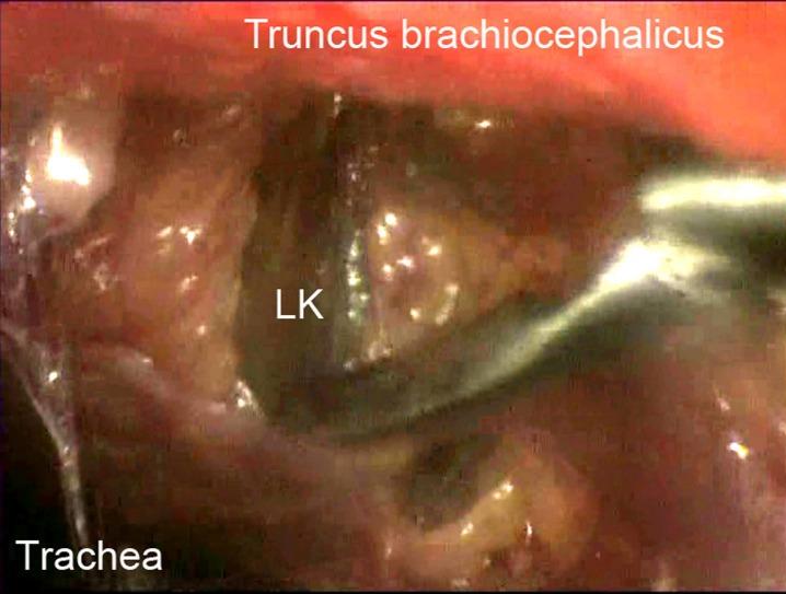 https://cdn.ncbi.nlm.nih.gov/pmc/blobs/2201/3544208/930b2a54ff5b/CTO-11-05-g-009.jpg