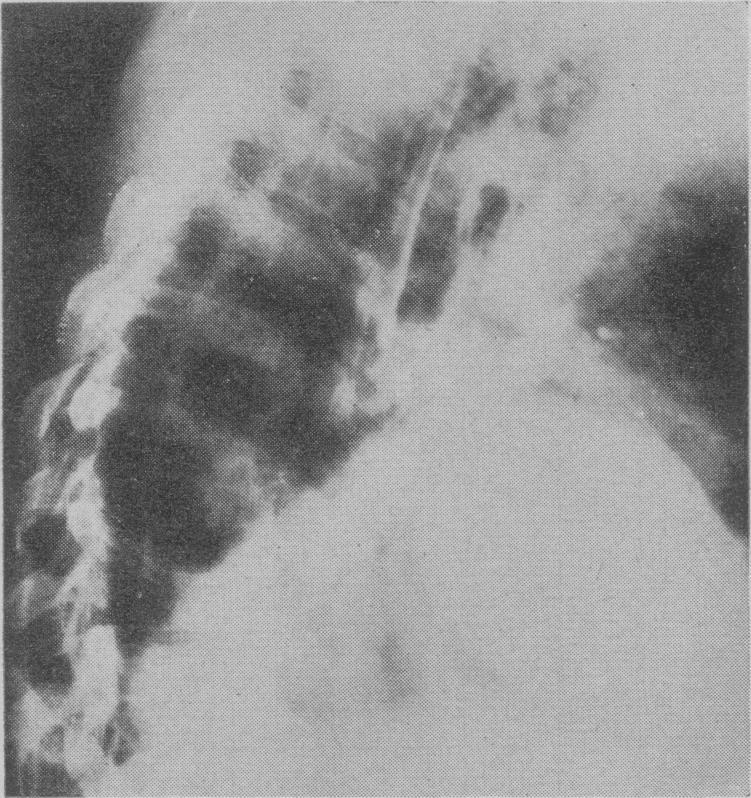 https://cdn.ncbi.nlm.nih.gov/pmc/blobs/2206/1889366/26f1b572bcab/procrsmed00369-0078-a.jpg