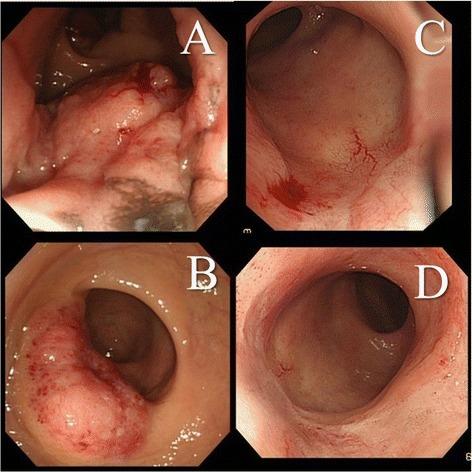 https://cdn.ncbi.nlm.nih.gov/pmc/blobs/2206/4747969/9a038140bb1b/40792_2015_25_Fig2_HTML.jpg