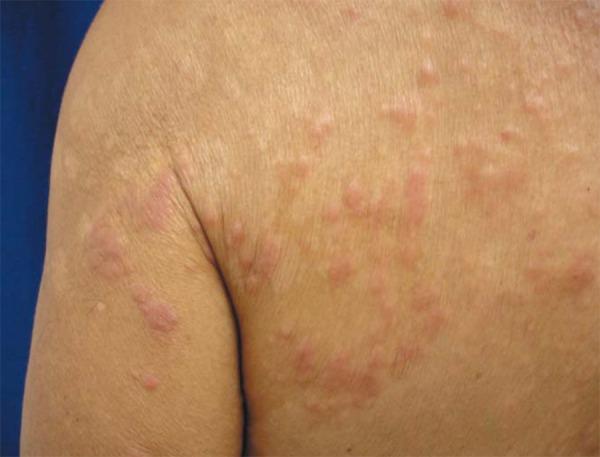 https://cdn.ncbi.nlm.nih.gov/pmc/blobs/220c/3699943/5cc63adcc2d5/abd-88-0105-g02.jpg