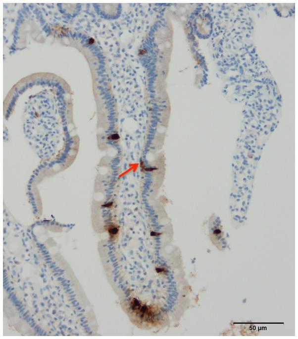 https://cdn.ncbi.nlm.nih.gov/pmc/blobs/2217/4887949/8cb230d1ea27/br-04-06-0651-g03.jpg