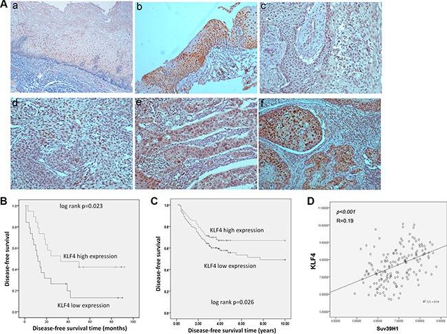 https://cdn.ncbi.nlm.nih.gov/pmc/blobs/2221/5312384/589086677f33/oncotarget-07-60290-g005.jpg