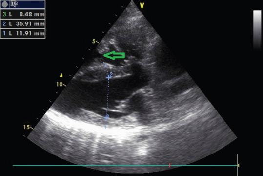 https://cdn.ncbi.nlm.nih.gov/pmc/blobs/2221/7799069/9e3c4b930499/JCE-30-162-g002.jpg