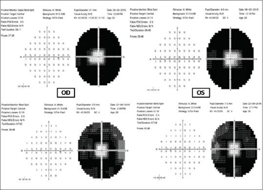 https://cdn.ncbi.nlm.nih.gov/pmc/blobs/2227/5565899/1e172c1de3c6/IJO-65-416-g008.jpg