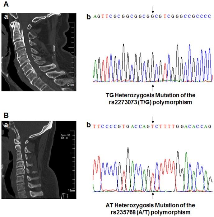 https://cdn.ncbi.nlm.nih.gov/pmc/blobs/2228/4156358/5b45577a728e/pone.0106598.g002.jpg