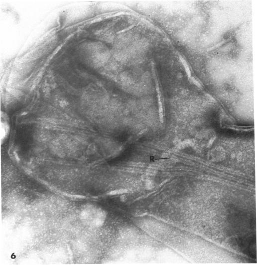 https://cdn.ncbi.nlm.nih.gov/pmc/blobs/2229/249773/de20ad1af8ee/jbacter00392-0446-a.jpg